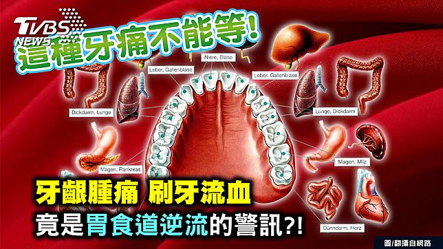 牙齦腫痛、刷牙流血可能是胃食道逆流的警訊(圖/TVBS提供)