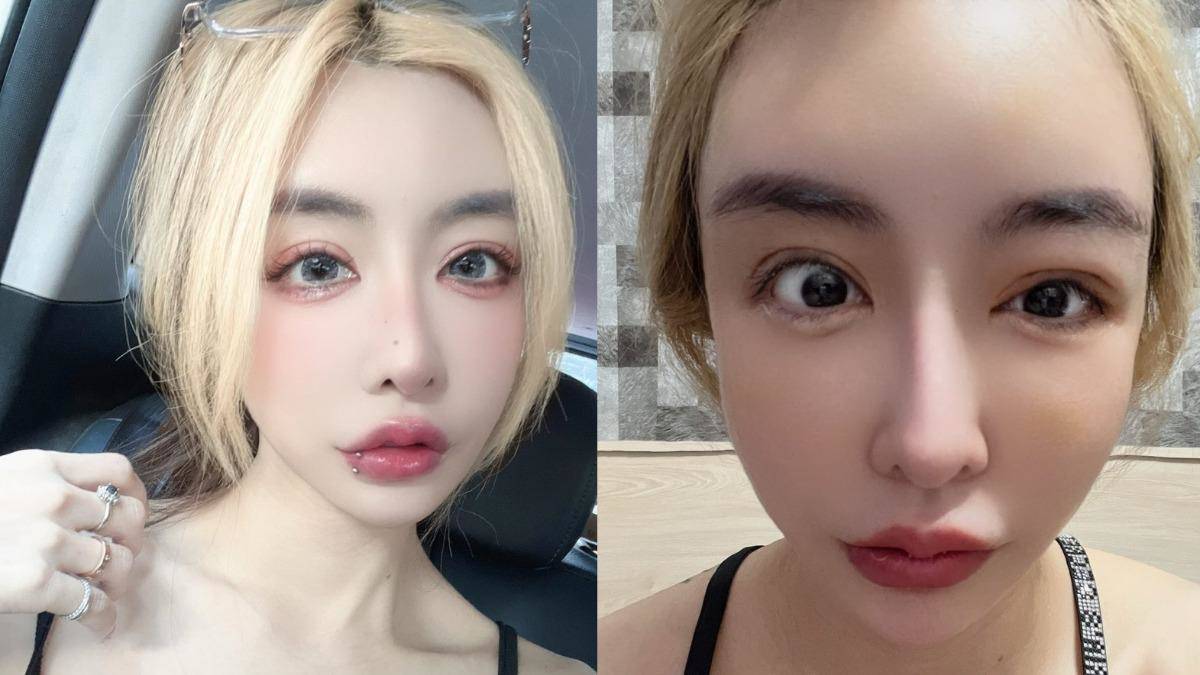 情色教主出事了！進廠維修8個月「眼睛閉不起來」 求醫簽切結書爆憂鬱| TVBS | LINE TODAY