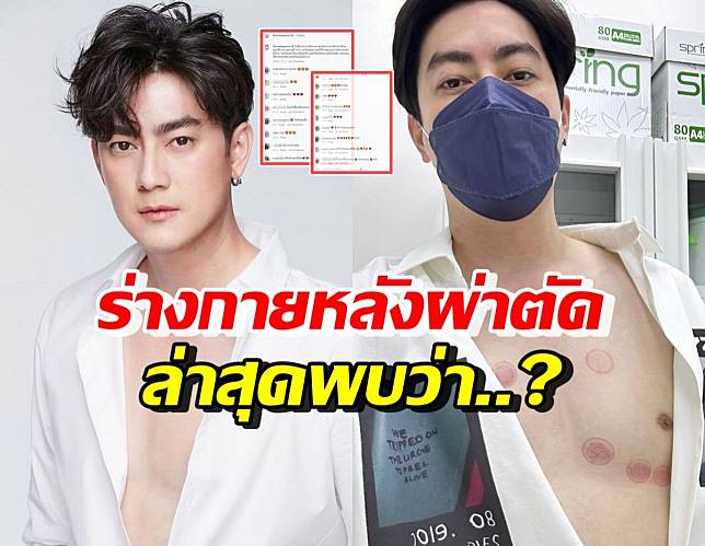 ฟิล์ม รัฐภูมิ ตรวจเช็กร่างกายล่าสุด หลังผ่าตัดลิ้นหัวใจรั่วระยะสุดท้าย พบว่า..?