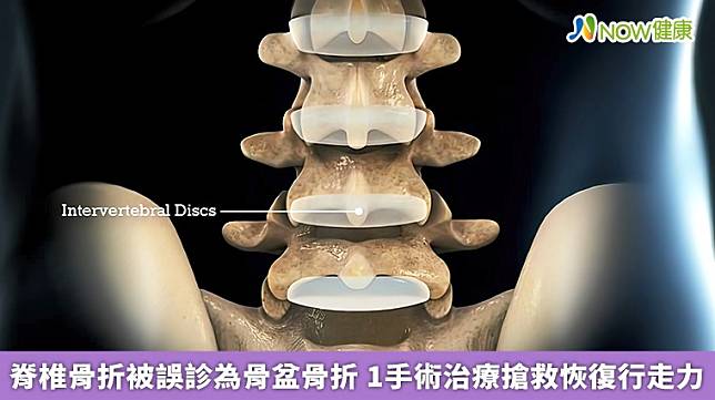 ▲長安醫院骨科醫師趙子鎔表示，隨著年紀增長或女性停經後，骨質密度容易降低，此時若不慎跌倒或搬重物，便容易發生脊椎壓迫性骨折。（圖／NOW健康製作；圖片來源／ingimage）