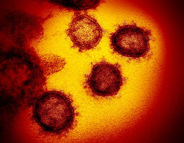在這張穿透式電子顯微鏡(Transmission electron microscope，TEM)的照片中，可以看到 2019新型冠狀病毒(2019-nCoV)的模樣，該病毒取自一名罹患COVID-19(武漢肺炎)的美國患者。圖中可以看到病毒從實驗室中培養的細胞表面出現，此病毒在電子顯微鏡下可以看到如日冕一般外圍的冠狀。 Photo: NIAID