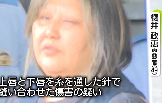 日本茨城縣一名49歲女子櫻井政惠，因為與室友激烈口角，竟然拿鋼針與線，硬生生把室友的嘴巴給縫起來。