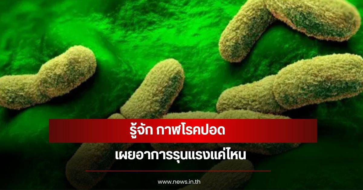 Getting to know 'Pneumonic Plague', a serious infectious disease that requires vigilance