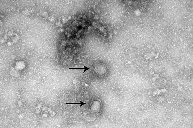A microscopic image of the first isolated case of the coronavirus. Photo: Chinese Centre for Disease Control and Prevention via Reuters