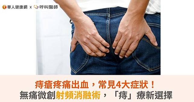 痔瘡疼痛出血，常見4大症狀！無痛微創射頻消融術，「痔」療新選擇