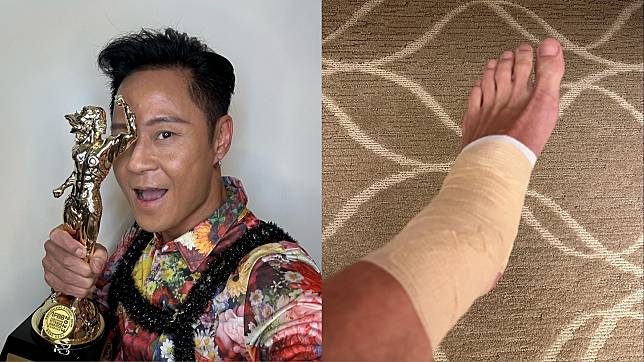 「草蜢」蔡一傑日前在澳門演出時不慎扭傷了腳。（翻攝自蔡一傑臉書）