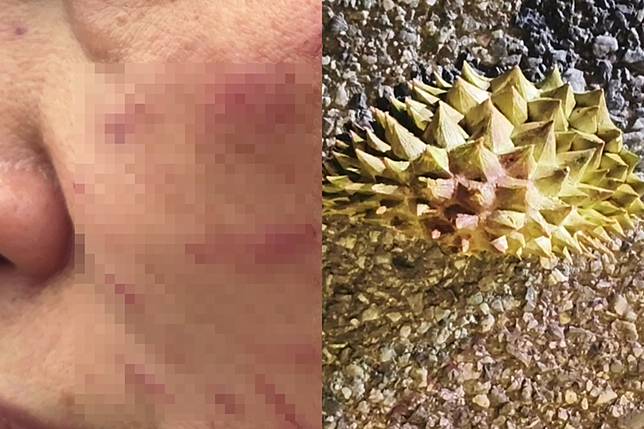 泰國一名人妻夜跑時突遭2名男子持榴槤皮猛歐。圖／翻攝自《dailynews》