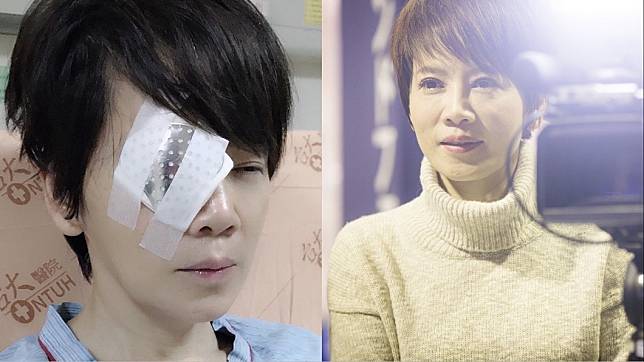 陳雅琳先前因視網膜剝離，右眼幾乎失明。（圖／翻攝自陳雅琳主播臉書）