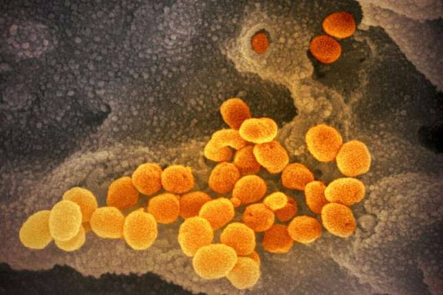 新冠肺炎疫情延燒，國衛院表示，目前已經完成「瑞德西韋」的毫克級合成，純度97%。圖為電子顯微鏡下的2019新型冠狀病毒。（資料照，美聯社）