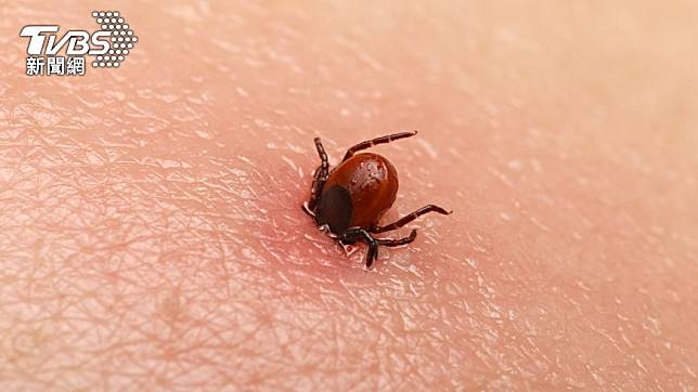 蜱蟲俗稱「壁蝨」或「八腳怪」，遭叮咬恐患萊姆病。（示意圖／Shutterstock達志影像）