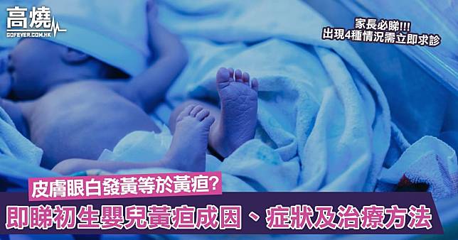 【初生嬰兒黃疸】初生嬰兒皮膚眼白發黃等於黃疸？即睇黃疸成因、症狀及治療方法！出現4種情況需立即求診