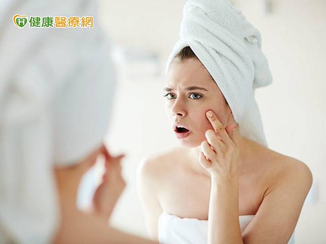 英國研究發現，容易長青春痘的人，皮膚老化速度較慢。