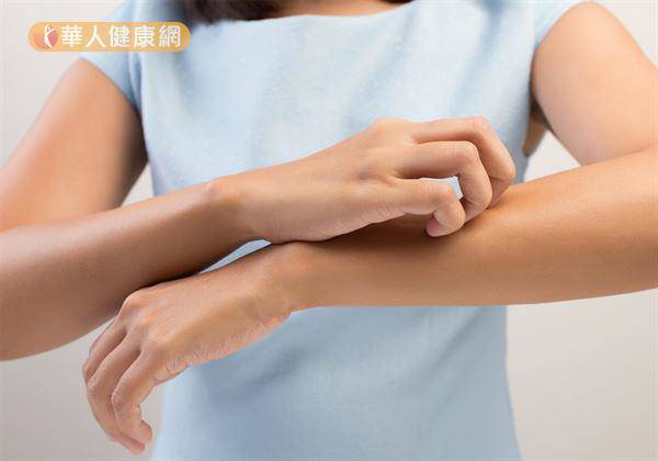 天冷易好發3大皮膚病！濕疹、乾癬、凍瘡這樣改善